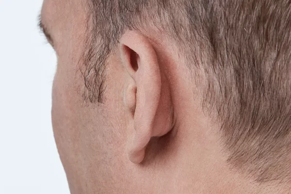 Oticon Own™ In-the-Ear Half Shell (ITE HS)